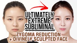 MOST ICONIC SUBLIMINAL❗ Angelic Face Zygoma Reduction Narrow Cheekbones upgraded formula [upl. by Weywadt287]